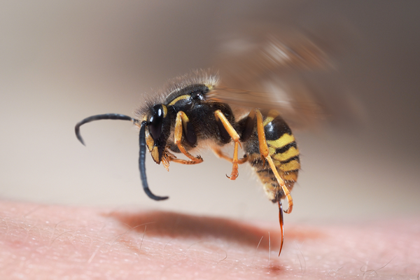 wasp sting